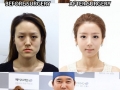 Twins get plastic surgery