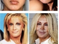 Plastic surgery