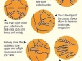 Key pressure points