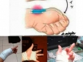 How to break your joint