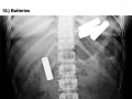 Stuff found in stomachs