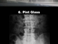 Painful x-rays of stuff that shouldn't go up there