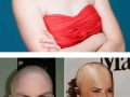 If female celebs were bald