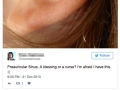 Why some people have little holes above their ears