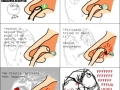 Damn you booger!