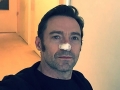 Hugh Jackman toasts after kicking cancers a**