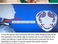 Worlds first human head transplant to take place in 8 months