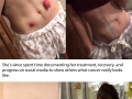 Cancer patients fitness transformation is incredible